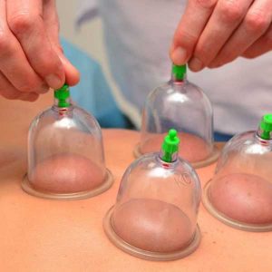 Cupping Therapy at Massage Masters